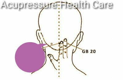 GB 20 Acupressure Point 